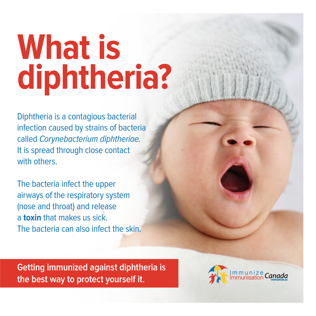 What is diphtheria? - image for Instagram