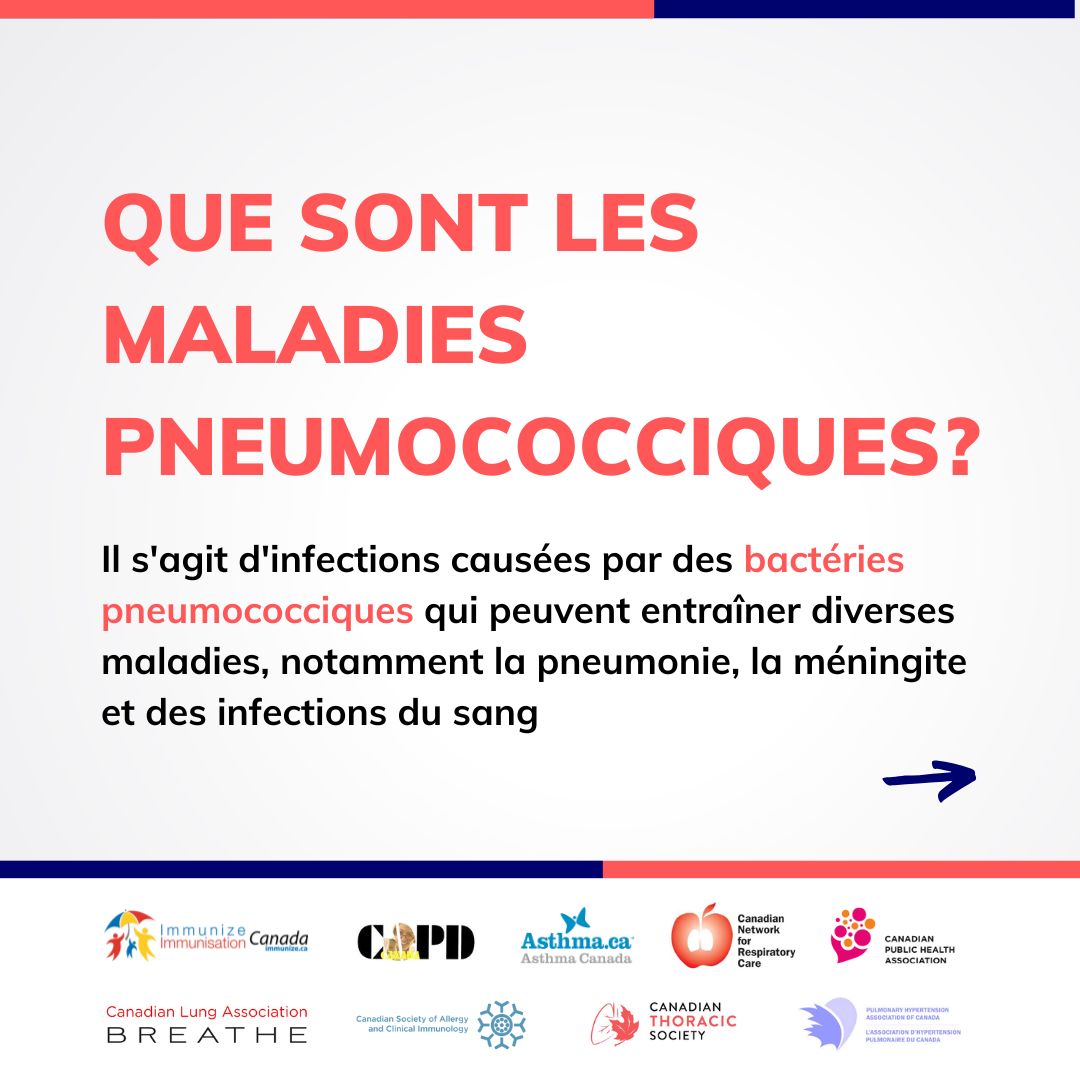 Que sont les maladies pneumococciques? (image pour médias sociaux)